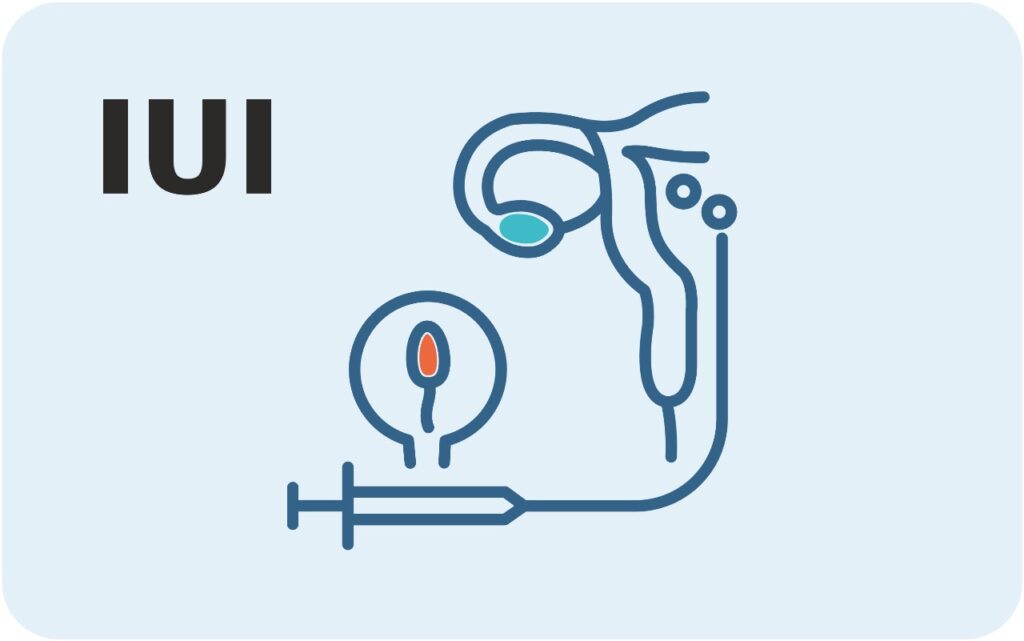 IUI