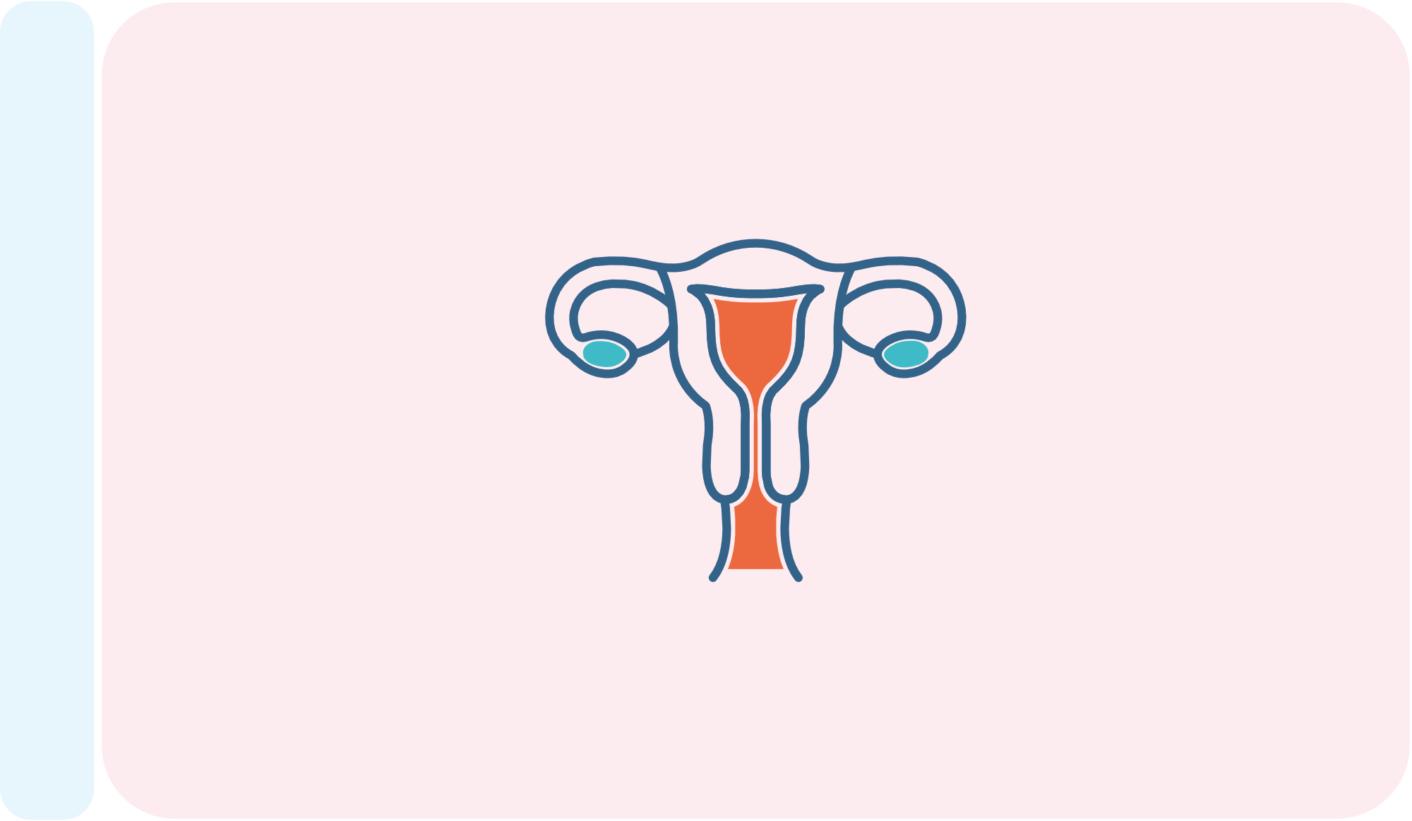 IUI