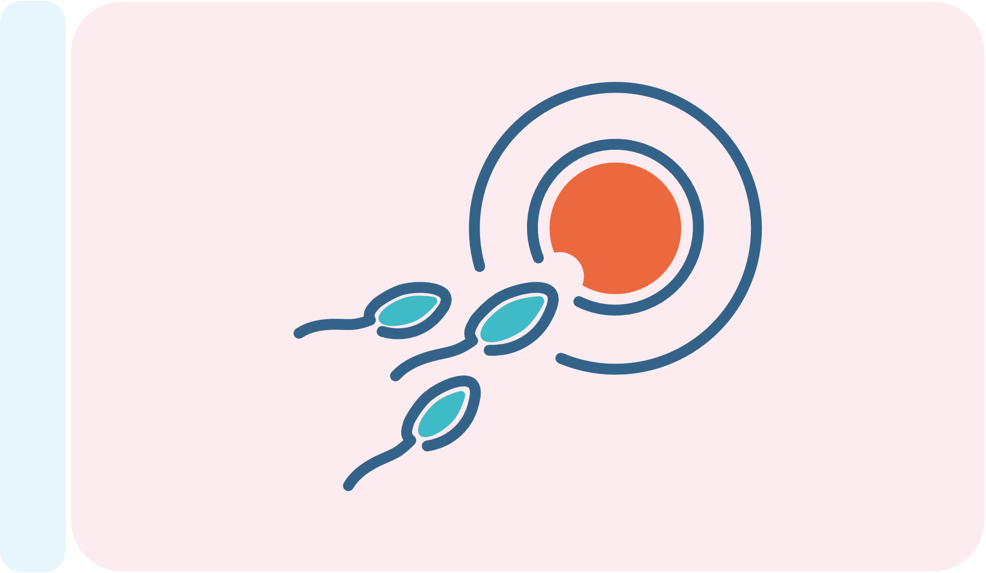 IVF